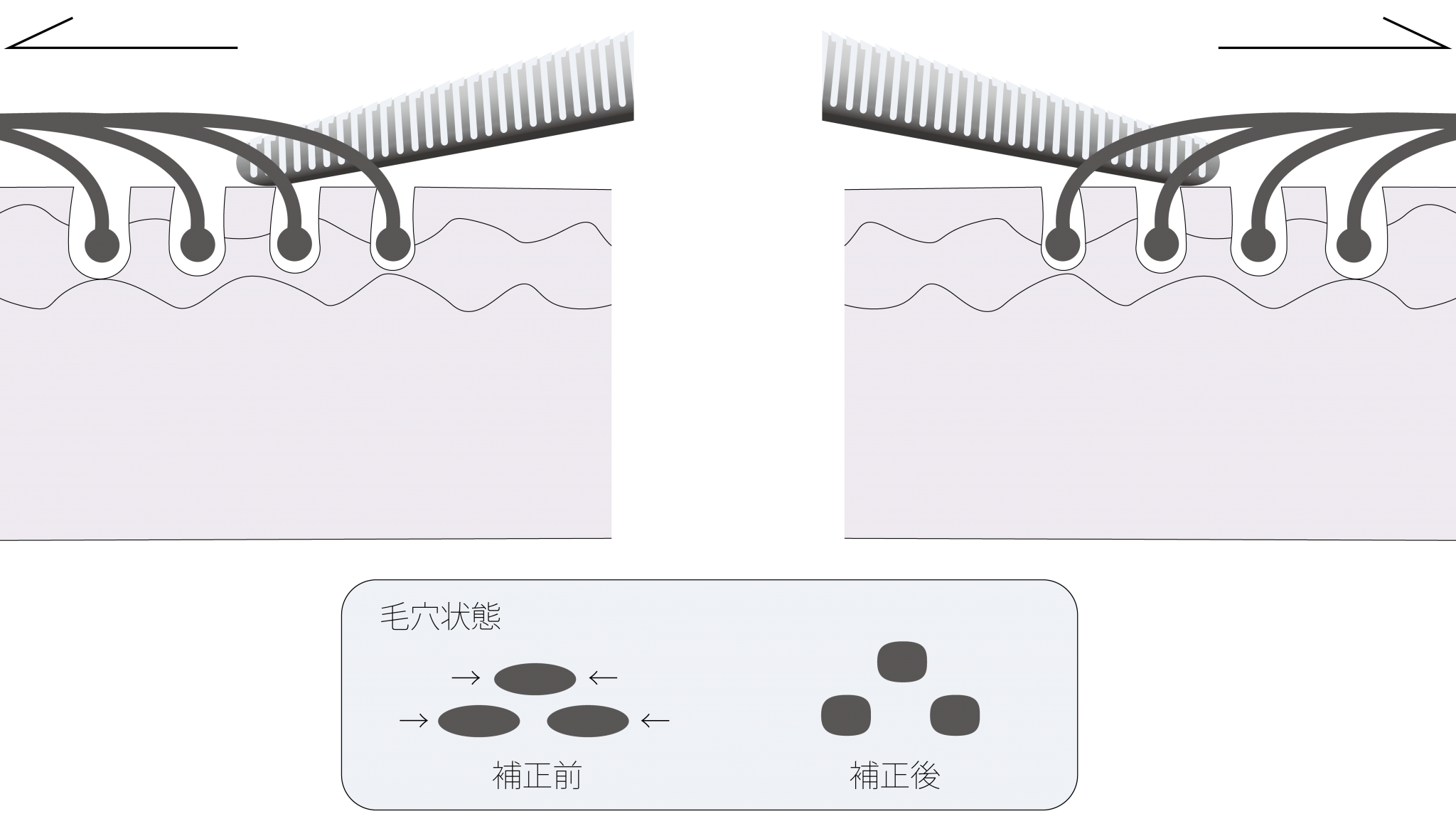 毛髪交差｜解きほぐす｜TOKIKATA｜ヘアリセッター